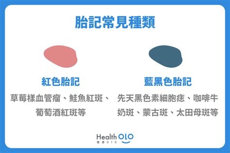 嬰兒 胎記|胎記怎麼產生、何時消除？醫師剖析胎記種類、胎記寓意